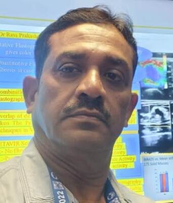 अल्ट्रासाउंड से गंभीर रोगों की मिलती है महत्वपूर्ण जानकारी- डा. रवि प्रकाश Ultrasound